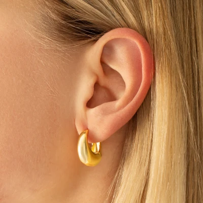 Aretes